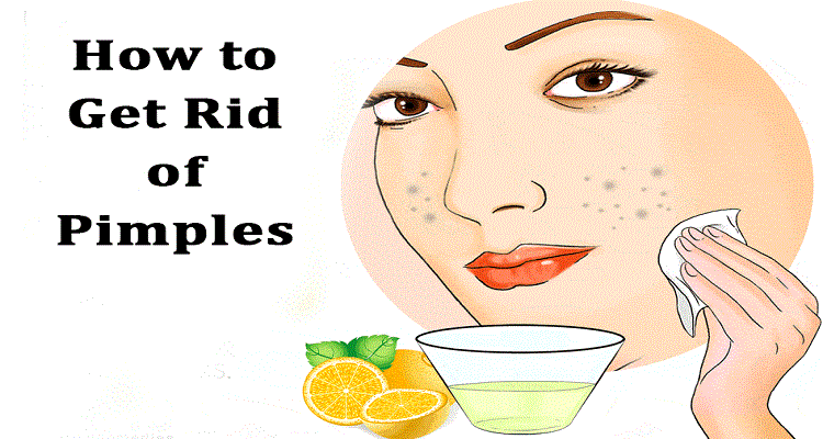 How to get rid of pimples