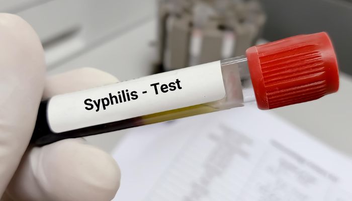 Rapid Syphilis Test