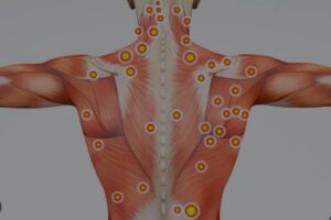 trigger point massage near me