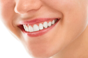 led teeth whitening singapore