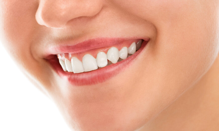 led teeth whitening singapore